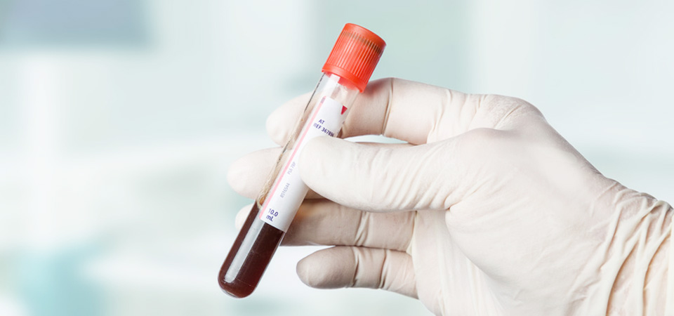 Blutuntersuchung – Medeno Medical Check-Up – Bremen