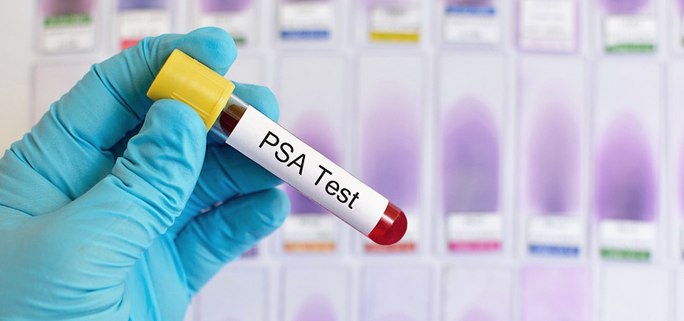 PSA-Test - Prostata – Medeno Medical Check-Up – Bremen